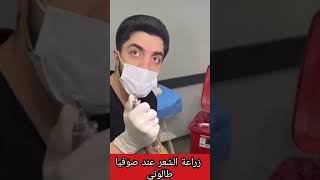 مانويلا الشرقاوي تكشف مراحل عملية زرع شعر لزوجها في مصحة صوفيا طالوني بتركيا