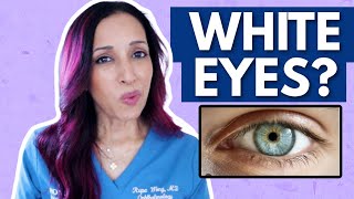 Why Your Eyes Aren't White | Eye Doctor Explains