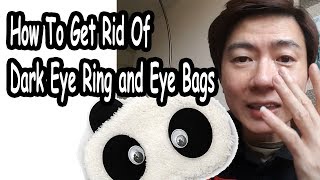 How To Get Rid of Dark Eye Rings And Eye Bags (No surgery!)