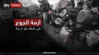 سوء تغذية وجوع حاد.. عنوان يختزل حال مئات الآلاف من سكان قطاع غزة