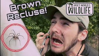 Brown Recluse BITE! The truth behind these spiders!