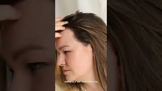 Thinning Hair Solution | Post-Partum Hair Loss