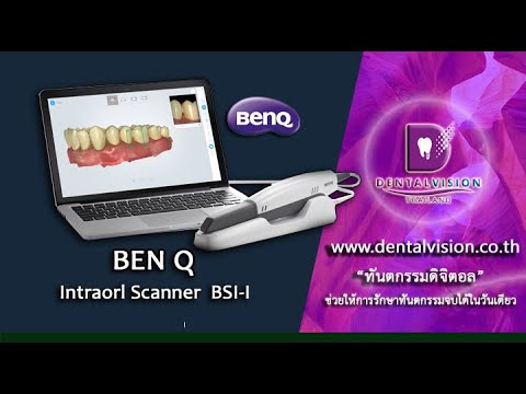 เครื่องมือทันตกรรม BenQ Intraoral  Scanner รุ่น BenQ BIS1 PR