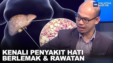 Kenali Penyakit Hati Berlemak & Rawatan | MHI (21 Jun 2023)