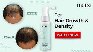 Hair Vitalizer with 3% Redensyl | Hair Growth | Mars | Procapil #haircare #hairgrowth