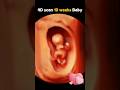 Happy 10 week baby 4d ultrasound scan  pregnancy subscribe embryo share