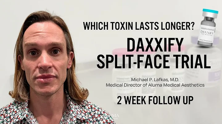 Daxxify Split-Face Trial | 2 Week Update