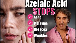 AZELAIC ACID!! Do You Need It In Your Skin Care Routine