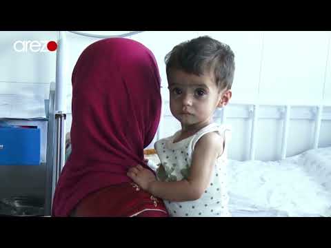 په خوارځواکۍ د اخته ماشومانو له زیاتوالي اندیښنې