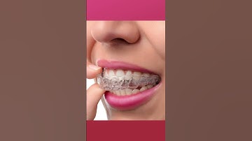 Niềng răng xong có cần đeo hàm duy trì không? #shorts #xuhuong