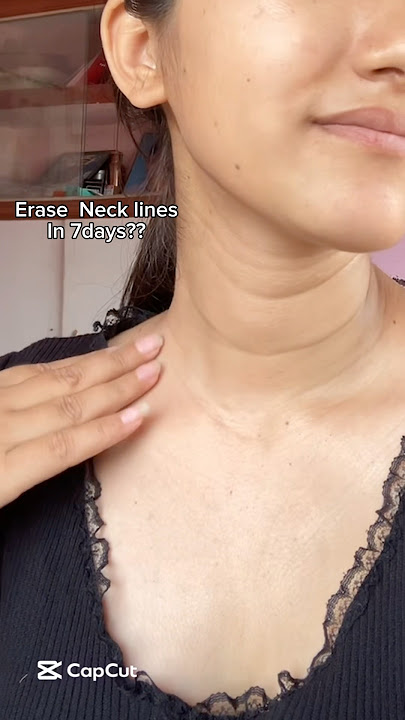 Erase Neck line in 7days?😱 #shorts #viralvideo #retinol #korean #7daysglow #beauty #koreanskincare