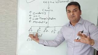 Nafld And Clinical Significance Of Grading Fibrosis