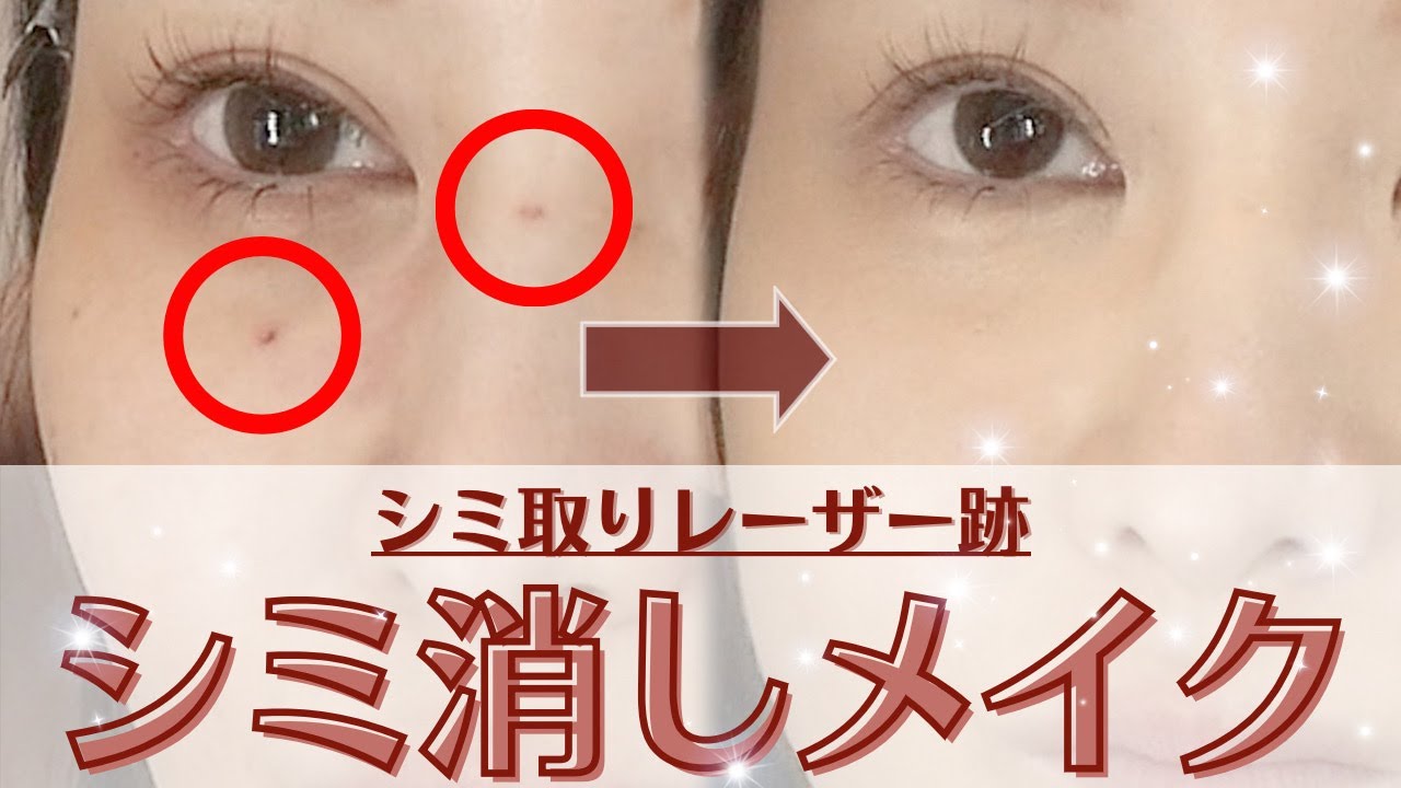 【メイク技】シミ取りレーザー治療後の跡をプロのヘアメイクが本気で隠す方法をご紹介！ - YouTube