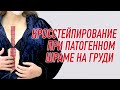 ✅ КРОССТЕЙПИРОВАНИЕ ПАТОГЕННОГО ШРАМА НА ГРУДНОЙ КЛЕТКЕ | Валентин Гайт | Учебный центр BBALANCE