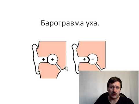 Способы выравнивания давления в полости уха. Продувка.