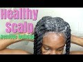 Easy steps to maintain a healthy scalp