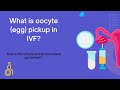 What is oocyte (egg) pickup in IVF? |Dr.RamaRaju || Krishna IVF Clinic ||