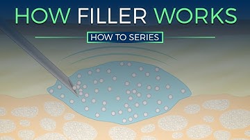 How Dermal Fillers Work - HOW TO SERIES