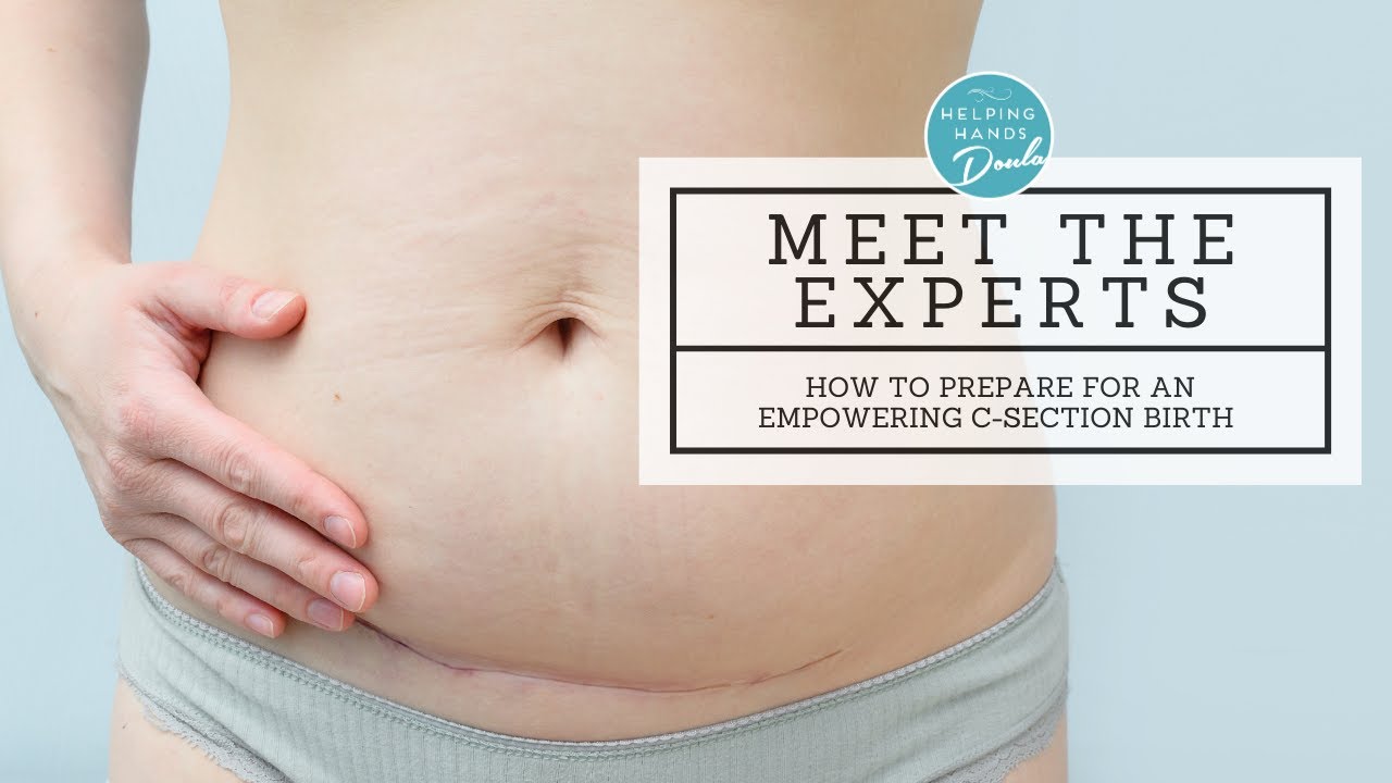 Meet the Team! What you need to know about preparing for a C-Section ...