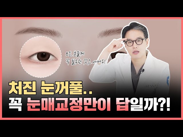 추욱~처진 눈꺼풀... 눈매교정만이 답일까???