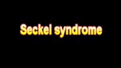 What Is The Definition Of Seckel syndrome Medical School Terminology Dictionary