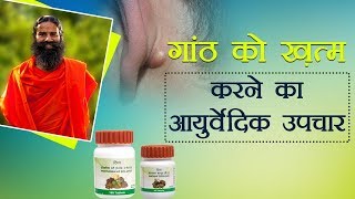 Ayurvedic Treatment for Lipoma (गांठ) | Swami Ramdev screenshot 4