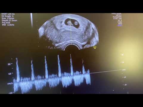 مشکلات ناباروری