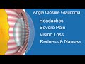 Narrow & Closed Angle Glaucoma