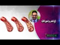ازاي تتخلص من الدهون الثلاثيه الدكتور أحمد أبو النصر 
