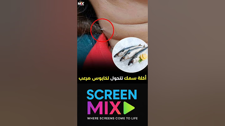 سيدة تايلندية تناولت وجبة سمك وابتلعت عن طريق الخطأ شوكة سمكة وعلقت في حلقها جربت كل الطرق التقليدية