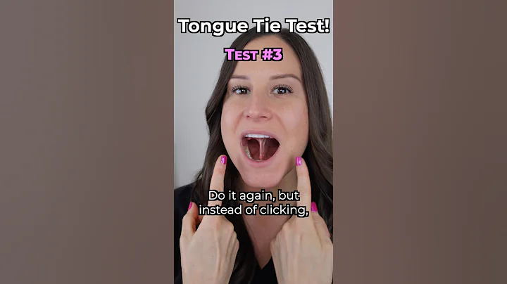 Do you have a Tongue Tie? (Quick test)