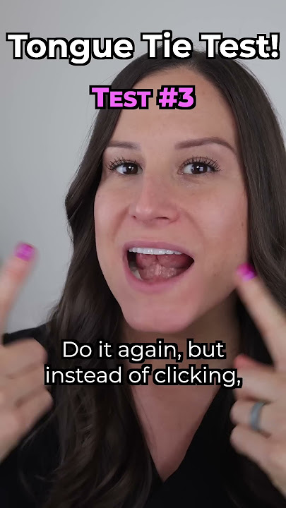 Do you have a Tongue Tie? (Quick test)