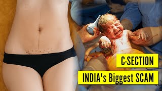 Indias Biggest SCAM | C-SECTION Delivery | Medical Fraud | Pregnancy| Shejal Bhadauria