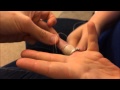 How to remove a ring from a swollen finger