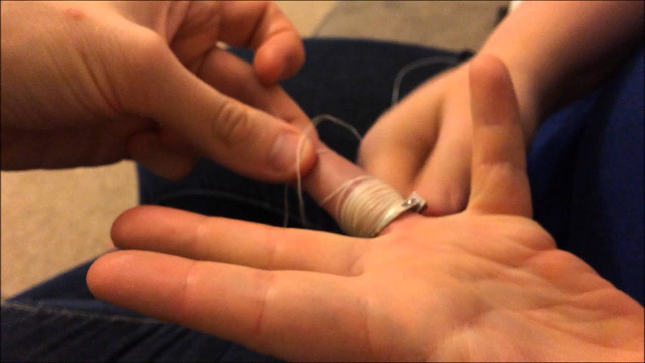 A doctor showed me how to remove the ring that was stuck on my finger -  YouTube