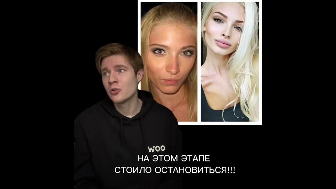 Две минуты позора алены шишковой. 2 минуты позора шишковой.