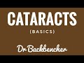 Cataracts basics and classification  ophthalmology