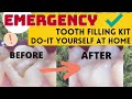 Emergency tooth filling kit diy at home easy fix solution