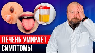 Первые признаки проблем с печенью! НЕ ИГНОРИРУЙ ЭТИ СИГНАЛЫ!