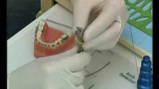 5 X Curvatrice Distale Per Filo Ortodontico In Acciaio Inox - Strumento Dentale Medentra