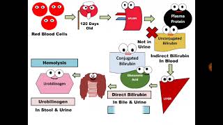 Urine Analysis 10. Bilirubin & Urobilinogen