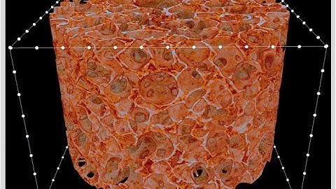 Lyophilization: Freeze drying pharmaceuticals