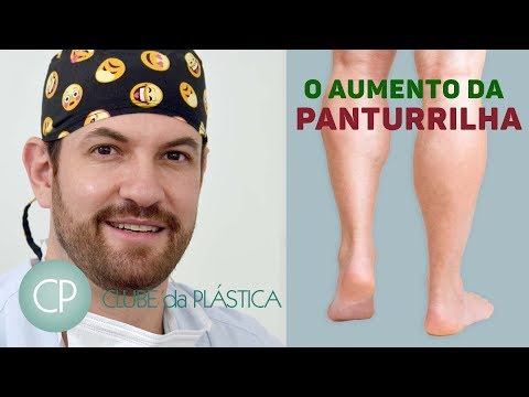 Vídeo: Implantes De Panturrilha: Procedimento, Custos E Muito Mais