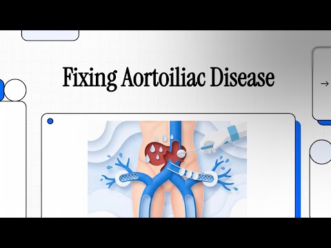 109 Fixing Aortoiliac Disease