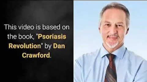 Causes Of Psoriasis - Psoriasis Revolution System Review