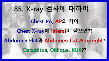 85. X-ray 검사에 대하여 - Chest AP, PA / Abdomen flat & upright / Decubitus, Oblique, KUB 등