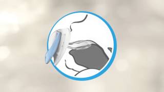 NUK Concepts: the shape and functions of NUK soothers