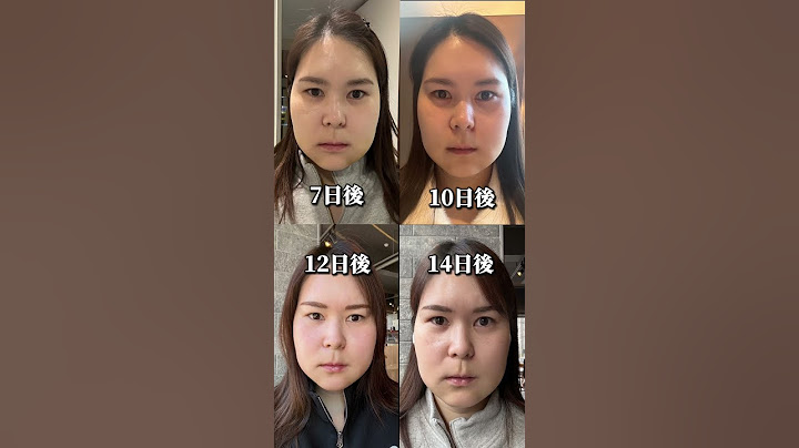整形したのに顔がもっとブサイクになりました