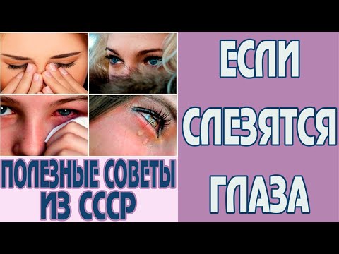 Слезятся глаза что делать? Слезятся глаза лечение. Почему слезятся глаза и что делать Советы из СССР