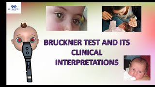 BRUCKNER TEST AND ITS INTERPRETATION